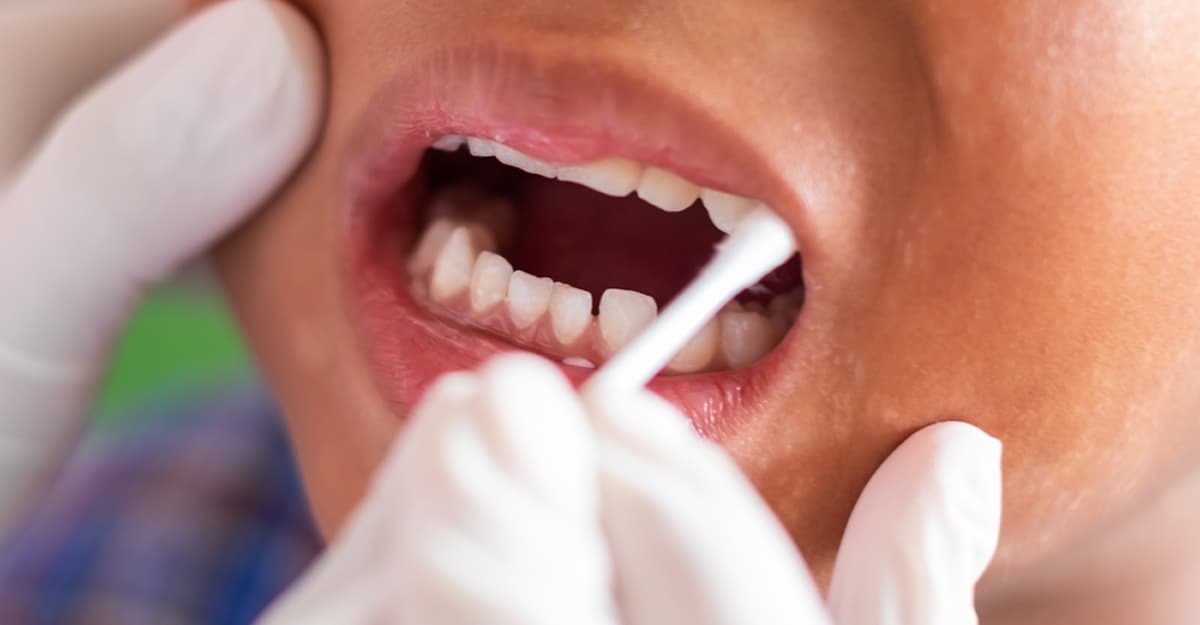 Fluoride: Is It Really Good For You?