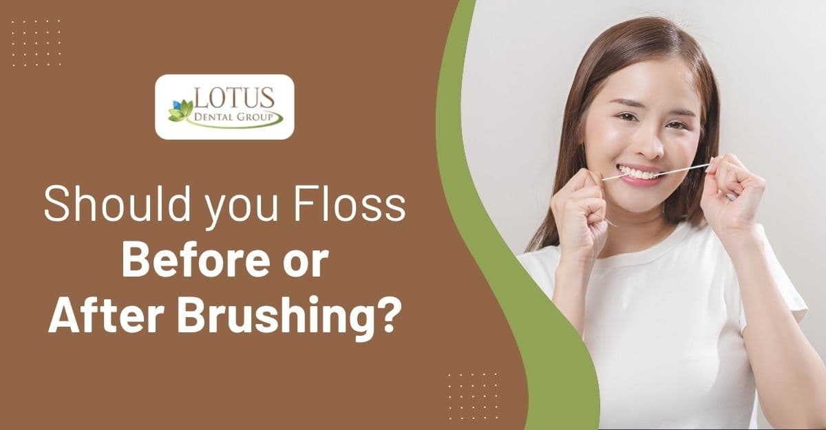 Should you Floss Before or After Brushing?