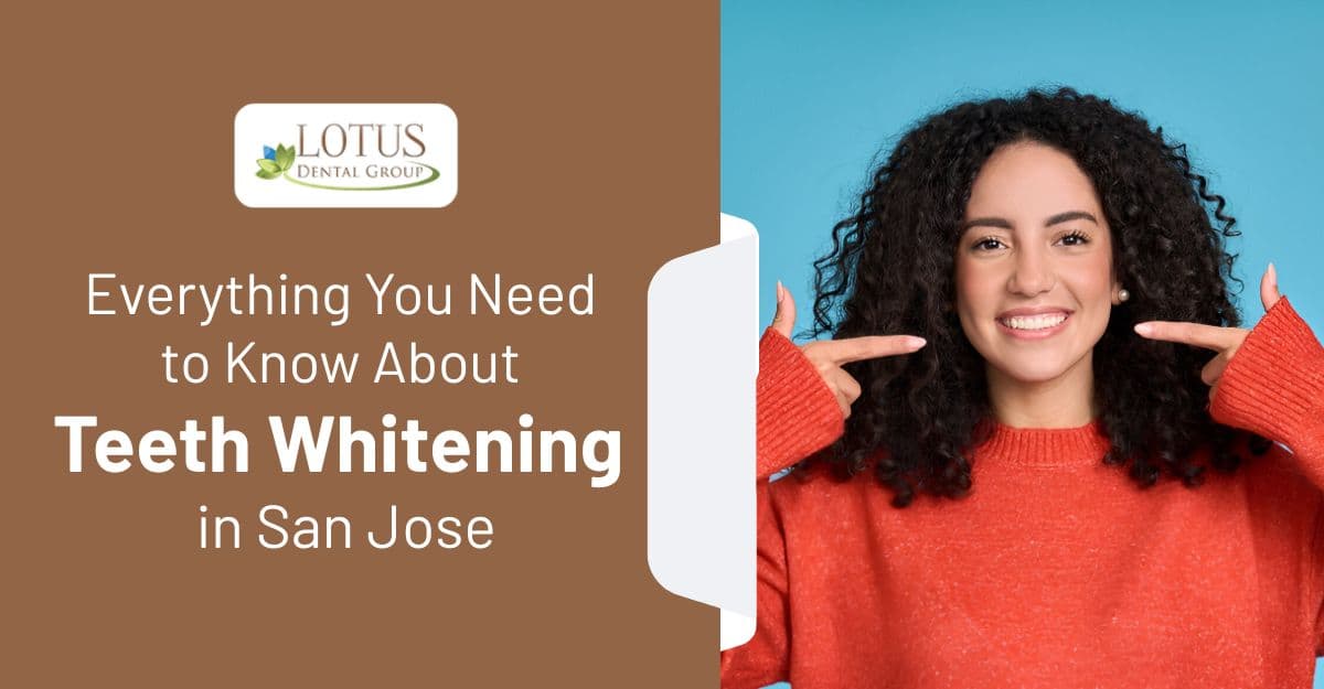 Everything You Need to Know About Teeth Whitening in San Jose