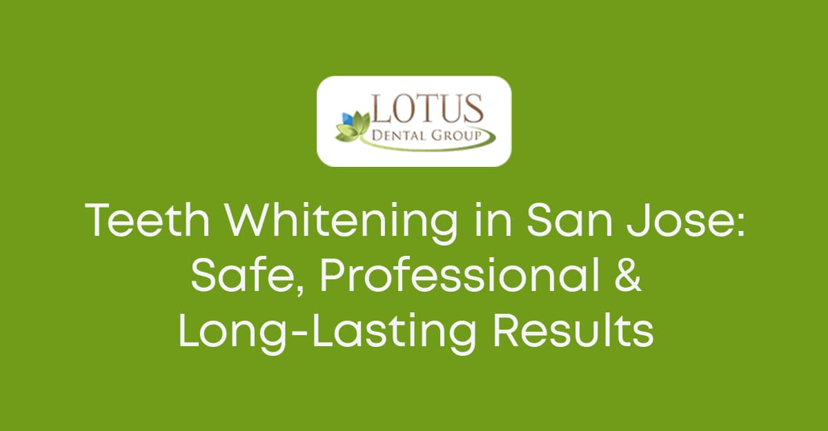 Professional Teeth Whitening in San Jose