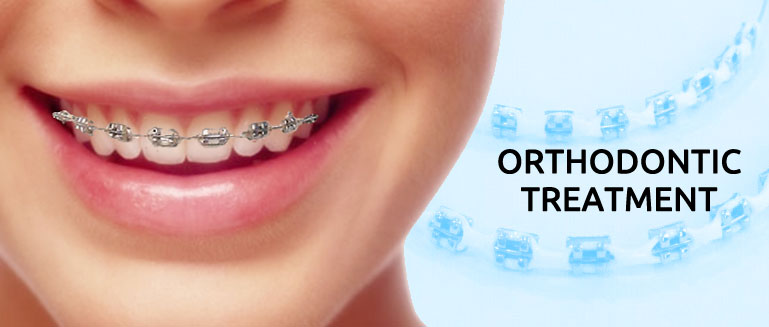 10 Surprising Myths About Orthodontic Treatment - Lotus Dental Group - Lotus Dental Group