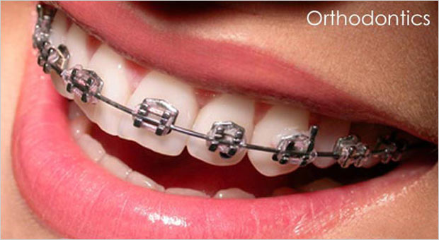 Enhance the beauty of your smile with Orthodontic treatment